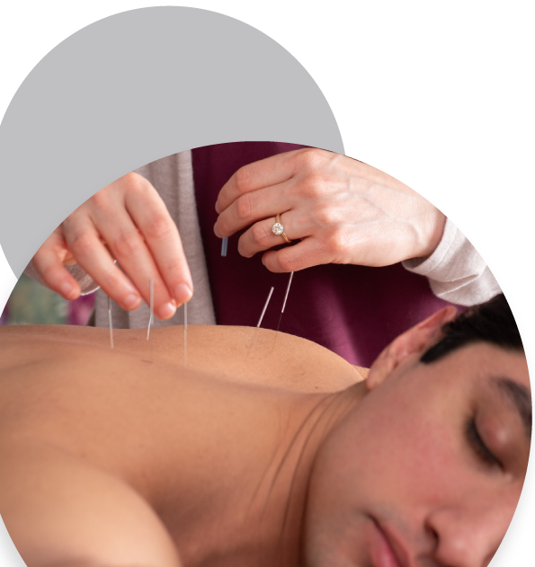 Treating patient with acupuncture